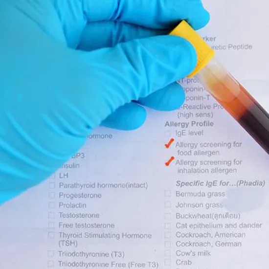 igm food allergy test